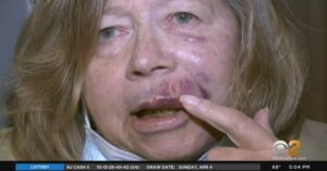 Woman Speaks Out After Being Sucker: Punched Live on Camera,From Interview to Assault