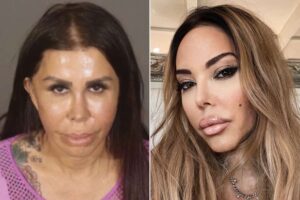 Butt Lady: Cindyana Santangelo ER episode,ER character,Silicone Injections